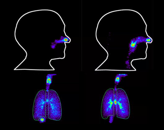 Gamma Scintigraphy at Quotient Sciences